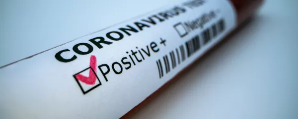 COVID-19 COVID-19 - Sputnik Lietuva