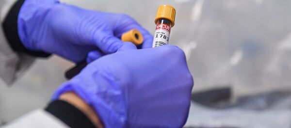 Лаборант держит в руках тест на антитела к COVID-19 - Sputnik Литва