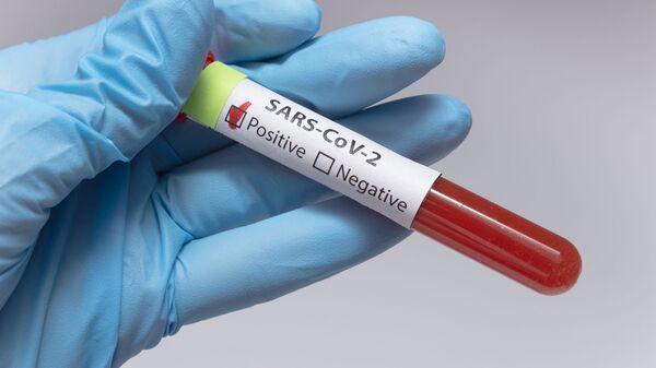 Положительный анализ крови на коронавирус - Sputnik Литва
