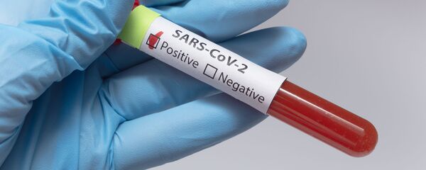 Положительный анализ крови на коронавирус - Sputnik Литва