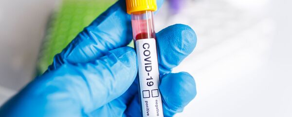 Тест на коронавирус Тест на коронавирус - Sputnik Литва