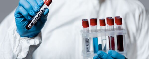 Тест на коронавирус - Sputnik Литва