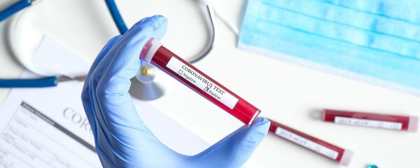 Koronaviruso tyrimai Koronaviruso tyrimai - Sputnik Lietuva