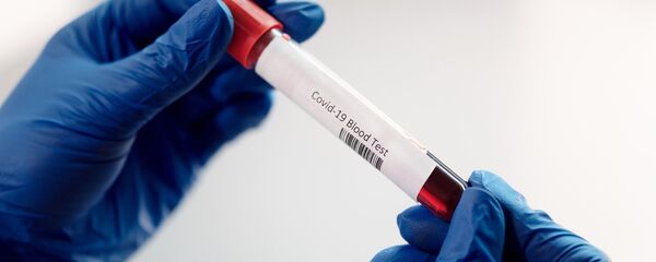 Тест на коронавирус - Sputnik Литва