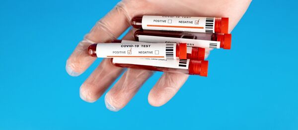 COVID-19 COVID-19 - Sputnik Lietuva