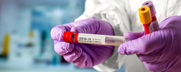 Тест на коронавирус Тест на коронавирус - Sputnik Lietuva