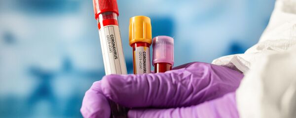 Тест на коронавирус Тест на коронавирус - Sputnik Lietuva