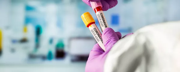 Тест на коронавирус Тест на коронавирус - Sputnik Lietuva