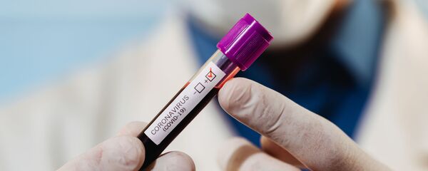 Тест на коронавирус Тест на коронавирус - Sputnik Lietuva