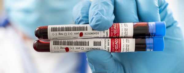 Тест на коронавирус - Sputnik Литва