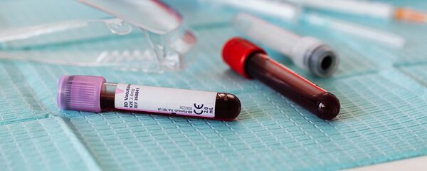 Тест на коронавирус Тест на коронавирус - Sputnik Lietuva