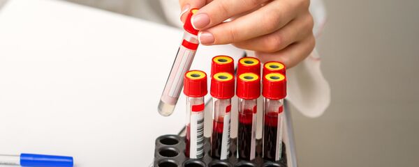 Тест на коронавирус  - Sputnik Литва