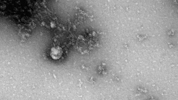 Фотография под микроскопом британского штамма коронавируса - Sputnik Lietuva