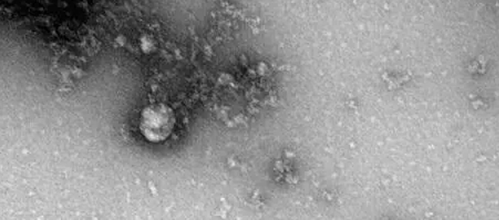 Фотография под микроскопом британского штамма коронавируса - Sputnik Lietuva, 1920, 02.02.2021