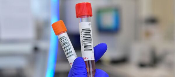 COVID-19 - Sputnik Lietuva