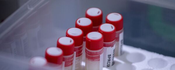 Тест на коронавирус Тест на коронавирус - Sputnik Lietuva