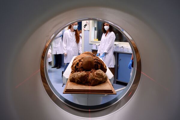 2021 metų birželio 21 dieną Milano Policlinico ligoninėje Egipto mumijai atliekama kompiuterinė tomografija, kad tyrėjai galėtų ištirti jos istoriją. - Sputnik Lietuva