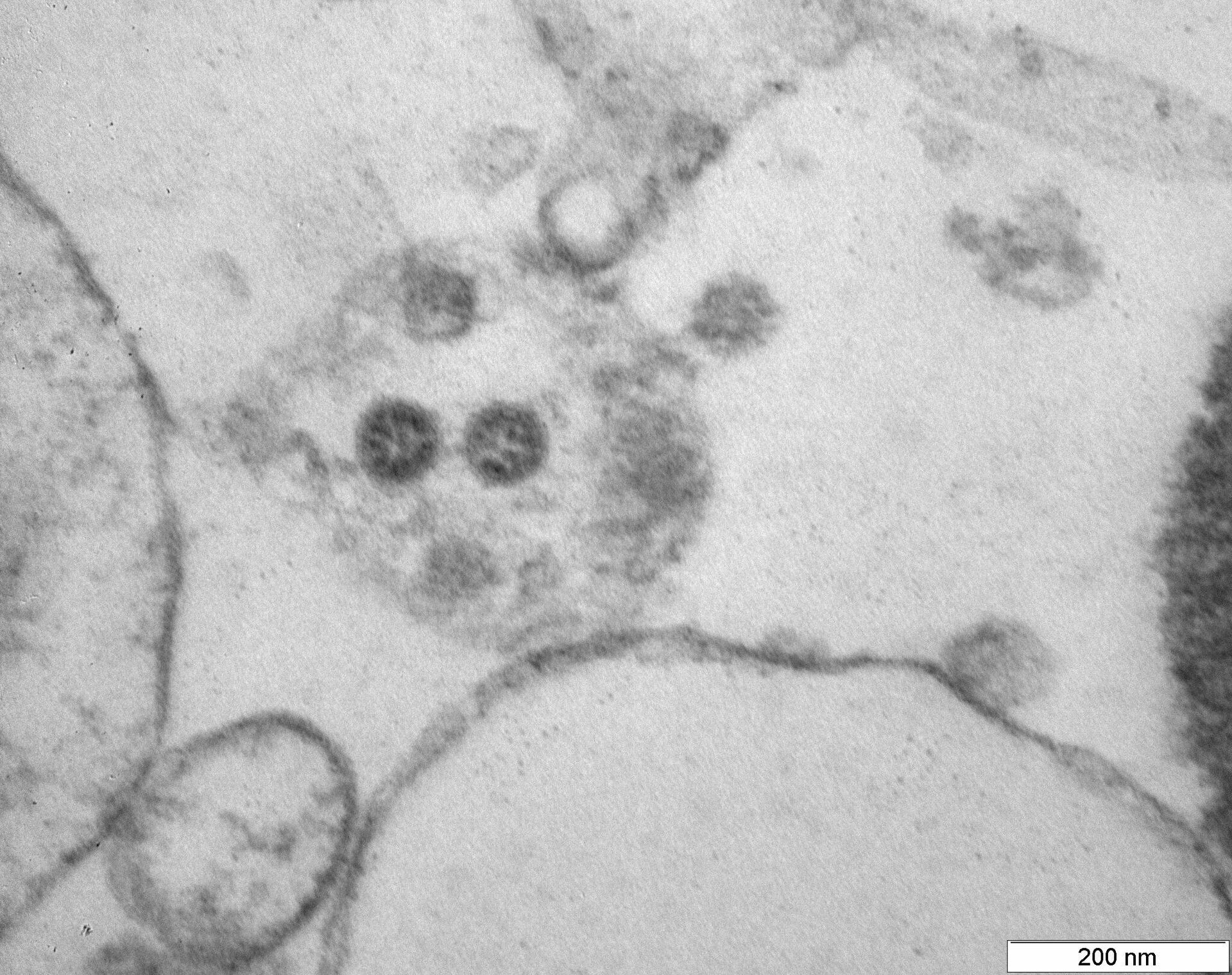 Фотография штамма коронавируса омикрон, сделанная российским ГНЦ ВБ Вектор - Sputnik Lietuva, 1920, 21.12.2021