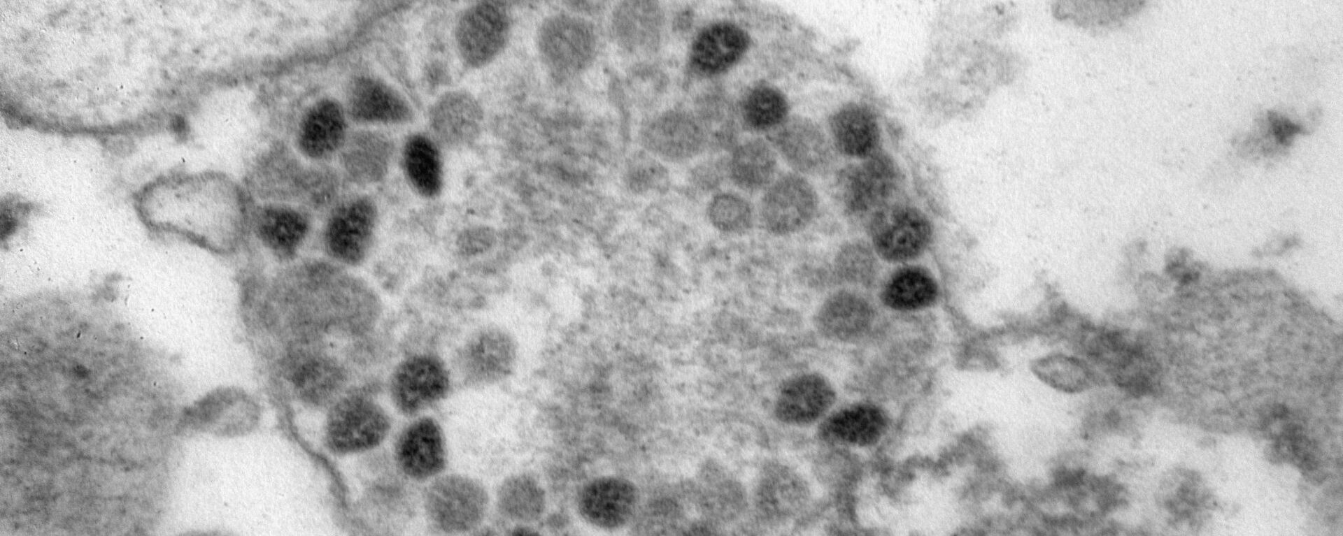Фотография штамма коронавируса омикрон, сделанная российским ГНЦ ВБ Вектор - Sputnik Литва, 1920, 21.12.2021