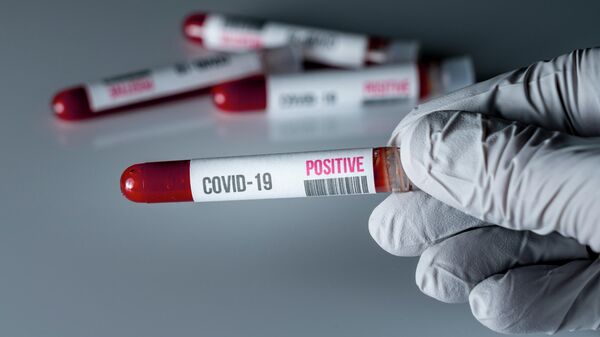 Тест на коронавирус, архивное фото - Sputnik Lietuva