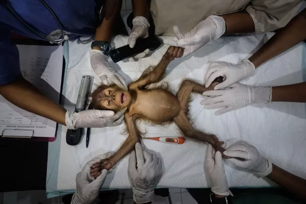 Belgijos fotografo Alaino Schroederio gamtos fotožurnalistikos kategorijoje pirmąją vietą laimėjusios trijų mėnesių orangutano patelės nuotrauka. Indonezijos Sumatros orangutanui kyla didžiulė grėsmė dėl nenutrūkstamo ir nuolatinio buveinių nykimo. Kadangi palmių aliejaus ir kaučiuko plantacijos, medienos ruoša, kelių tiesimas, kalnakasyba, medžioklė ir kita plėtra ir toliau intensyvėja, orangutanai yra priversti palikti savo natūralią atogrąžų miškų buveinę. Tokios organizacijos kaip OIC (Orangutanų informacijos centras) ir jų greitojo reagavimo komanda HOCRU gelbsti orangutanus, patekusius į sunkumus (pasiklydusius, sužeistus, paimtus į nelaisvę...), o SOCP (Sumatros orangutanų apsaugos programa) rūpinasi reabilituoja ir resocializuoja orangutanus specialiai sukurtoje medicinos įstaigoje, siekdama grąžinti juos į laukinę gamtą ir sukurti naujas savarankiškas, genetiškai gyvybingas populiacijas saugomuose miškuose. Tai, kad 97 % savo DNR dalijamės su orangutanais, atrodo akivaizdu, kai stebime į žmogų panašų jų elgesį. Šiandien, kai liko šiek tiek daugiau nei 14 000 individų, Sumatros orangutanas (Pongo Abelii) ir 800 neseniai atrastų tapanuli rūšių (Pongo tapanuliensis) yra įtrauktos į Tarptautinės gamtos apsaugos sąjungos (IUCN) sąrašą. Belgijos fotografo Alaino Schroederio gamtos fotožurnalistikos kategorijoje pirmąją vietą laimėjusios trijų mėnesių orangutano patelės nuotrauka. Indonezijos Sumatros orangutanui kyla didžiulė grėsmė dėl nenutrūkstamo ir nuolatinio buveinių nykimo. Kadangi palmių aliejaus ir kaučiuko plantacijos, medienos ruoša, kelių tiesimas, kalnakasyba, medžioklė ir kita plėtra ir toliau intensyvėja, orangutanai yra priversti palikti savo natūralią atogrąžų miškų buveinę. Tokios organizacijos kaip OIC (Orangutanų informacijos centras) ir jų greitojo reagavimo komanda HOCRU gelbsti orangutanus, patekusius į sunkumus (pasiklydusius, sužeistus, paimtus į nelaisvę...), o SOCP (Sumatros orangutanų apsaugos programa) rūpinasi reabilituoja ir resocializuoja orangutanus specialiai sukurtoje medicinos įstaigoje, siekdama grąžinti juos į laukinę gamtą ir sukurti naujas savarankiškas, genetiškai gyvybingas populiacijas saugomuose miškuose. Tai, kad 97 % savo DNR dalijamės su orangutanais, atrodo akivaizdu, kai stebime į žmogų panašų jų elgesį. Šiandien, kai liko šiek tiek daugiau nei 14 000 individų, Sumatros orangutanas (Pongo Abelii) ir 800 neseniai atrastų tapanuli rūšių (Pongo tapanuliensis) yra įtrauktos į Tarptautinės gamtos apsaugos sąjungos (IUCN) sąrašą. - Sputnik Lietuva