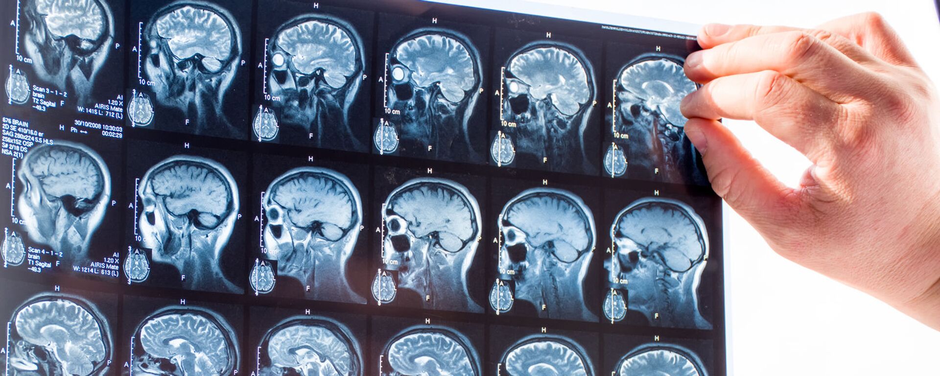 Врач изучает снимки головного мозга человека, архивное фото - Sputnik Литва, 1920, 11.05.2022