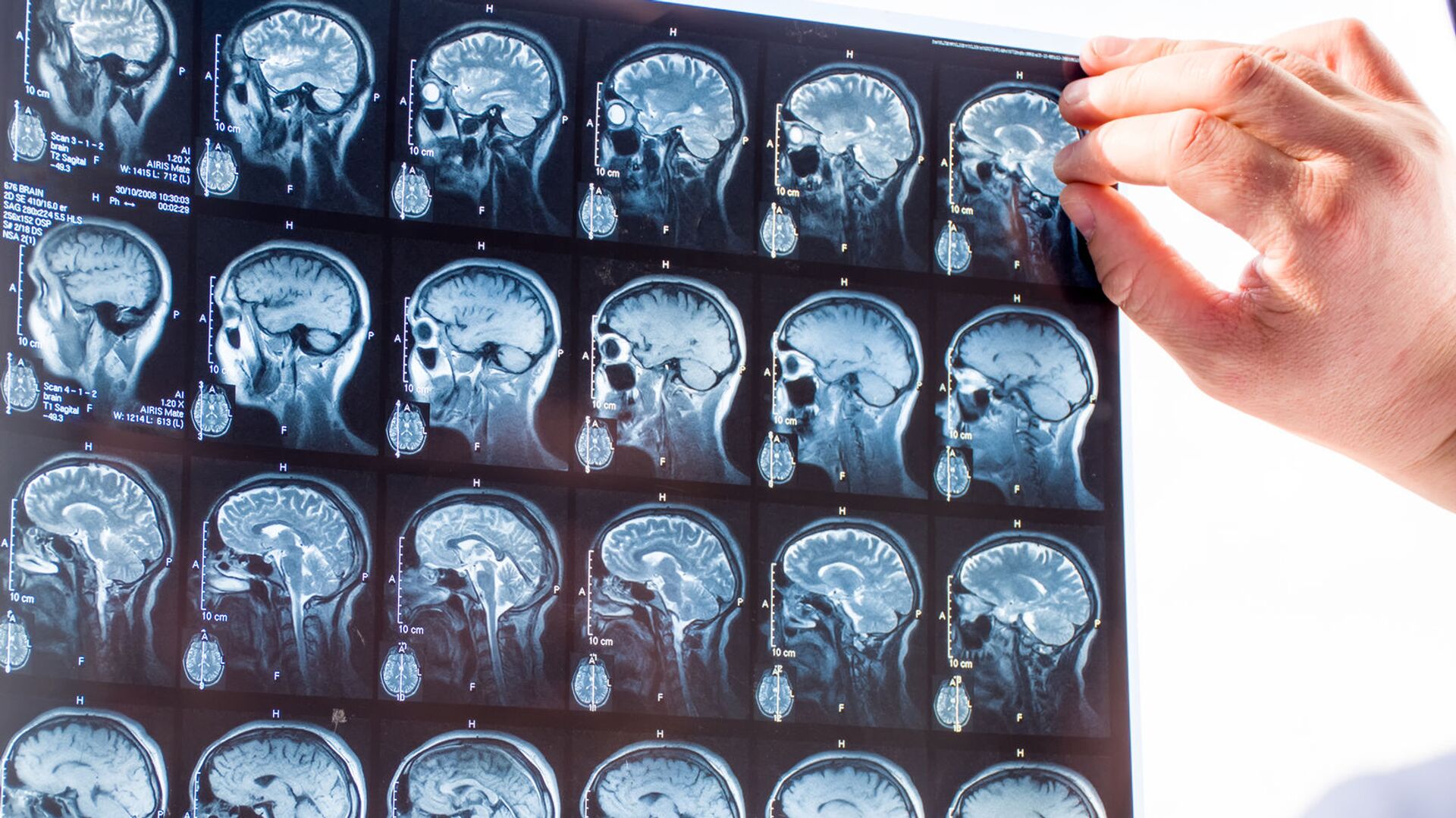 Gydytojas tiria žmogaus smegenų nuotraukas - Sputnik Lietuva, 1920, 15.12.2021