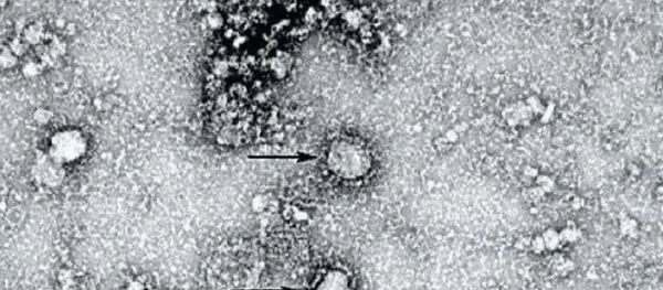 2019-nCoV, архивное фото 2019-nCoV, архивное фото - Sputnik Lietuva