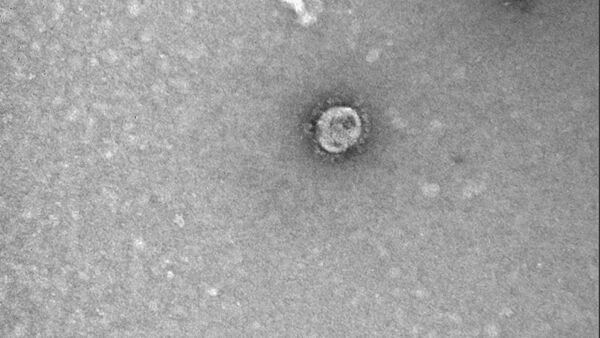 Снимок коронавируса COVID-19, опубликованный Роспотребнадзором - Sputnik Lietuva