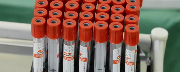 Koronaviruso tyrimai - Sputnik Lietuva