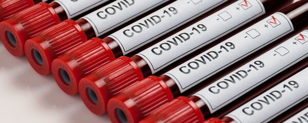 Образцы с положительными тестами на коронавирус - Sputnik Литва