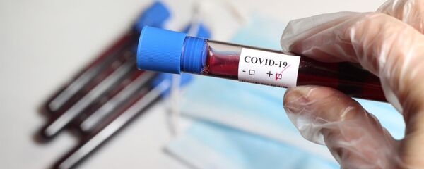 Положительный тест на коронавирус - Sputnik Литва