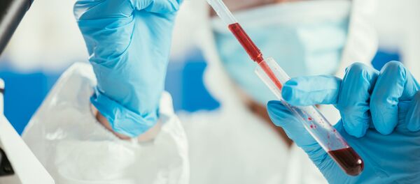 Медицинский работник с образцом крови Медицинский работник с образцом крови - Sputnik Lietuva