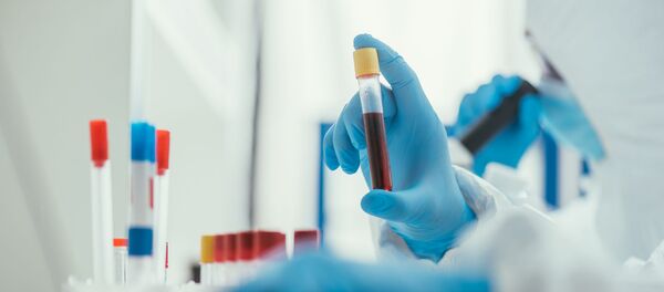 Лаборант с образцом крови - Sputnik Литва