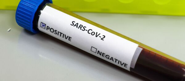Образец крови с положительным тестом на коронавирус - Sputnik Литва