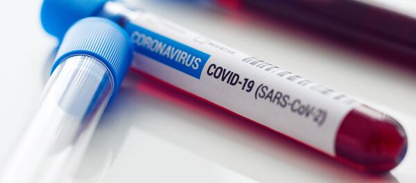 Образцы крови для теста на коронавирус  - Sputnik Литва