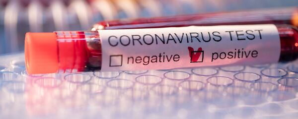 Образец крови с положительным тестом на коронавирус Образец крови с положительным тестом на коронавирус - Sputnik Литва
