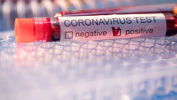 Образец крови с положительным тестом на коронавирус - Sputnik Lietuva