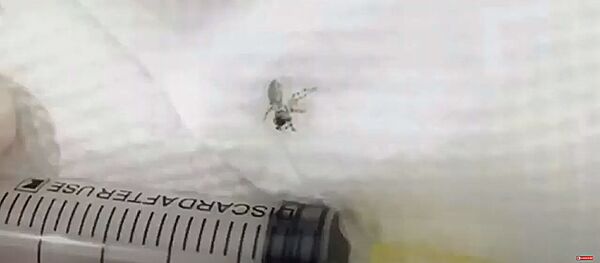 Доктор из Китая удалил паутину из уха пациента Доктор из Китая удалил паутину из уха пациента - Sputnik Lietuva