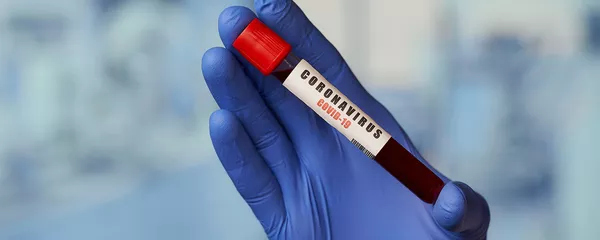 Положительный тест на коронавирус - Sputnik Lietuva