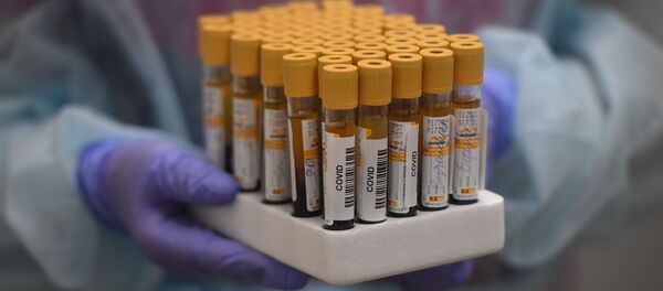 Пробирки с кровью для анализа на антитела к коронавирусу COVID-19 - Sputnik Литва