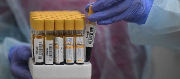 Пробирки с кровью для анализа на антитела к коронавирусу COVID-19 - Sputnik Литва