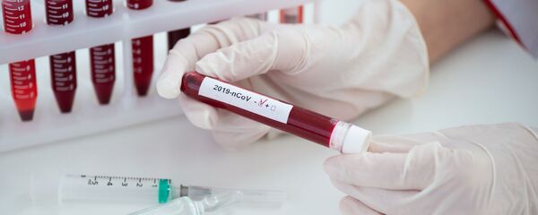 Положительный тест на коронавирус - Sputnik Литва