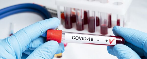 Положительный тест на коронавирус - Sputnik Литва