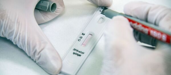 Экспресс-диагностика на антитела к коронавирусу в клинике Hadassah Medical Moscow в Сколково Экспресс-диагностика на антитела к коронавирусу в клинике Hadassah Medical Moscow в Сколково - Sputnik Литва