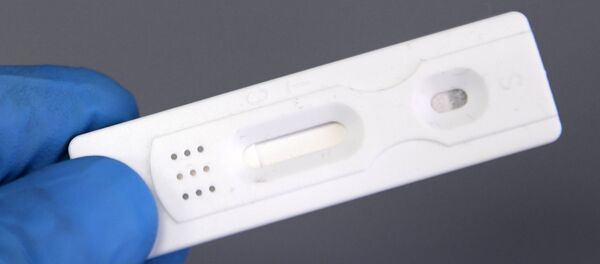 Тест-система на антитела к COVID-19 Тест-система на антитела к COVID-19 - Sputnik Lietuva