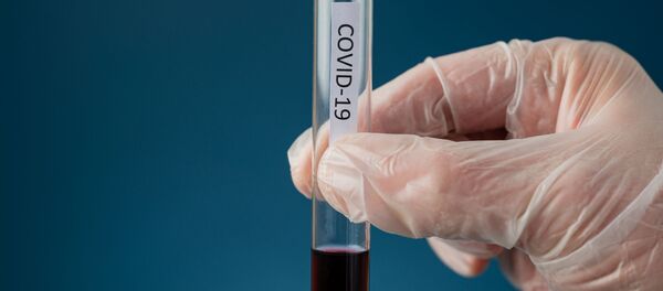 Тест на коронавирус Тест на коронавирус - Sputnik Lietuva