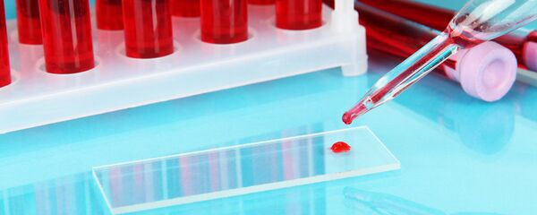 Анализ крови - Sputnik Литва