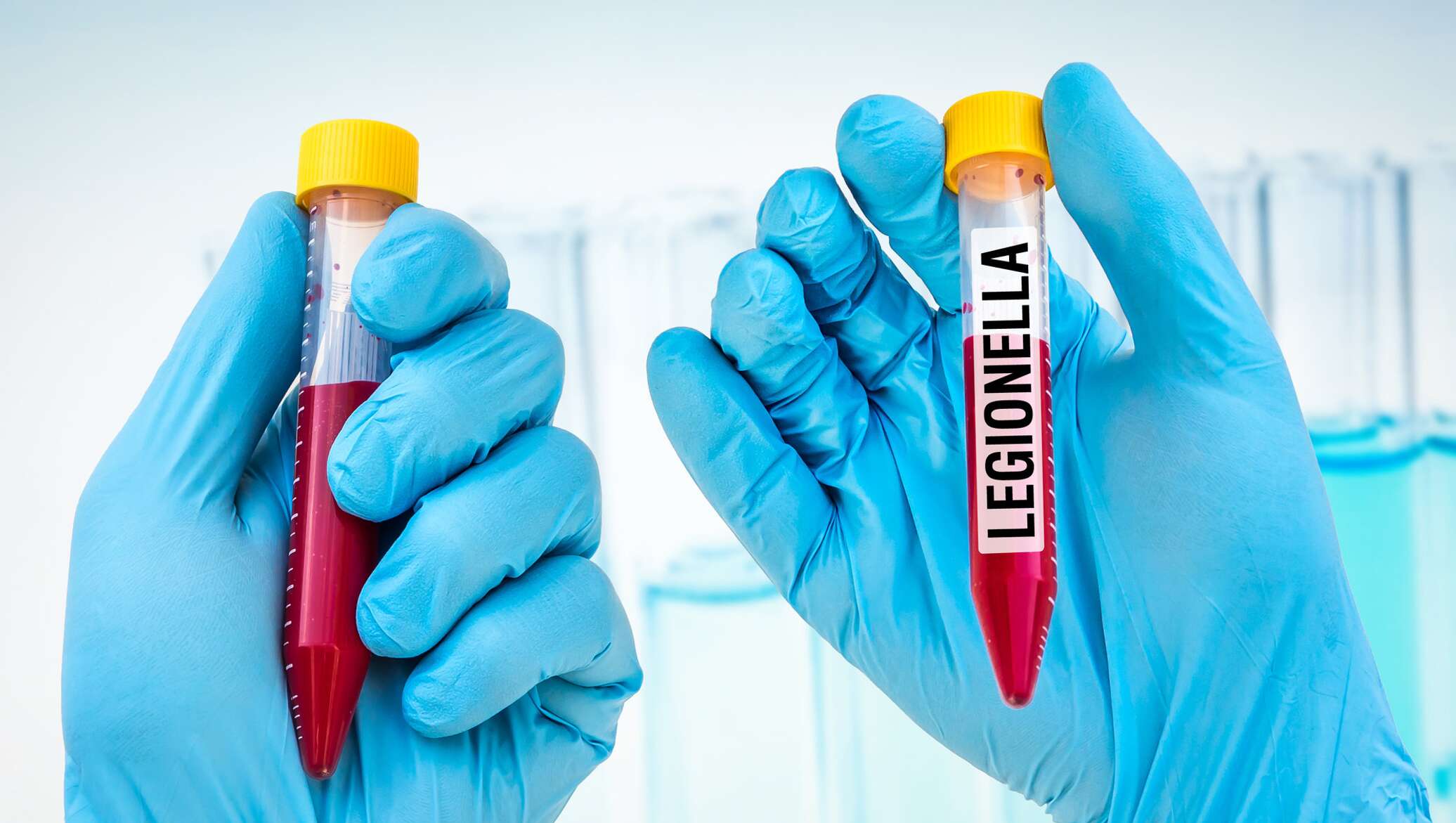 Что такое легионеллез
