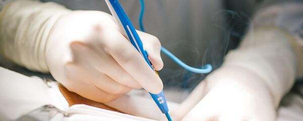 Операция по удалению злокачественной опухоли - Sputnik Литва